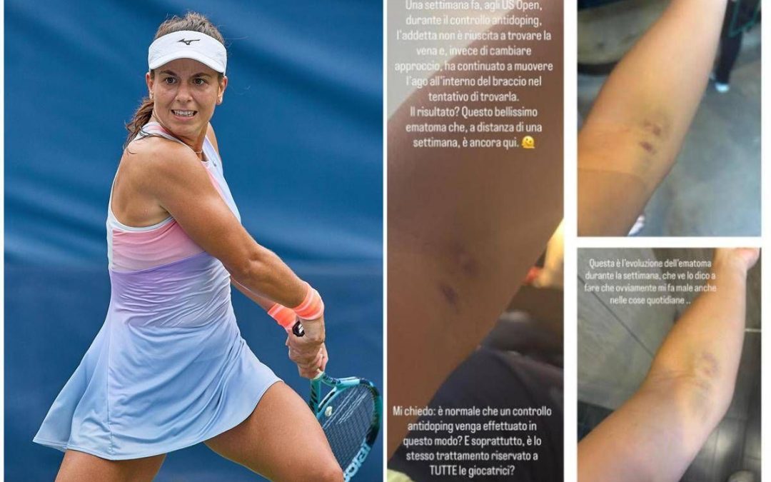 US Open, Stefanini e il livido sul braccio: “Colpa di un controllo antidoping…”