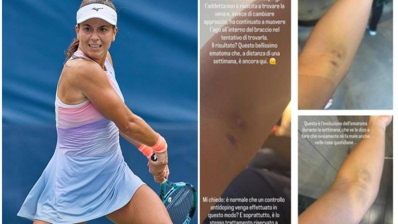 US Open, Stefanini e il livido sul braccio: “Colpa di un controllo antidoping…”