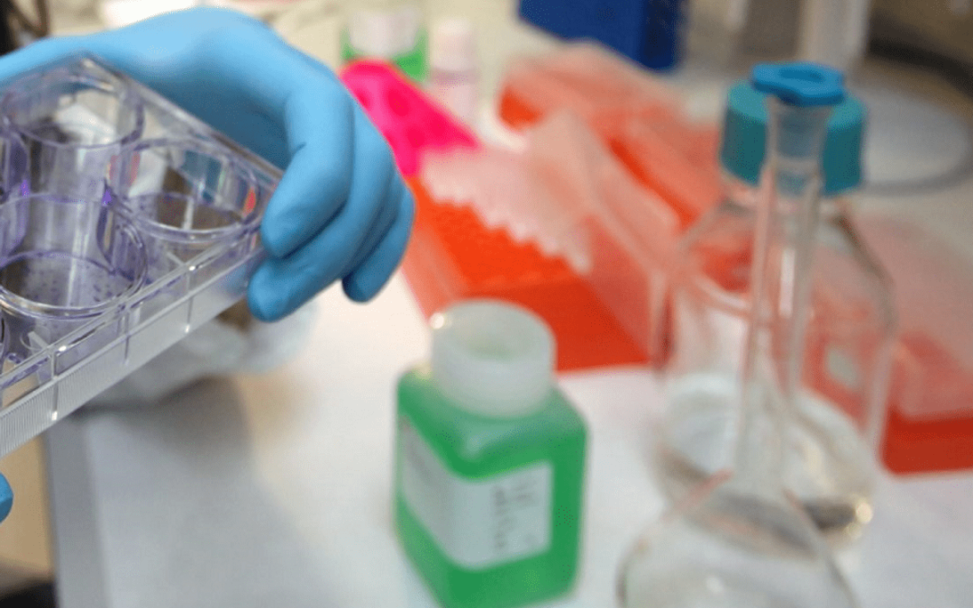 Tumori, al via studio per ridurre rischio recidive da cancro al seno