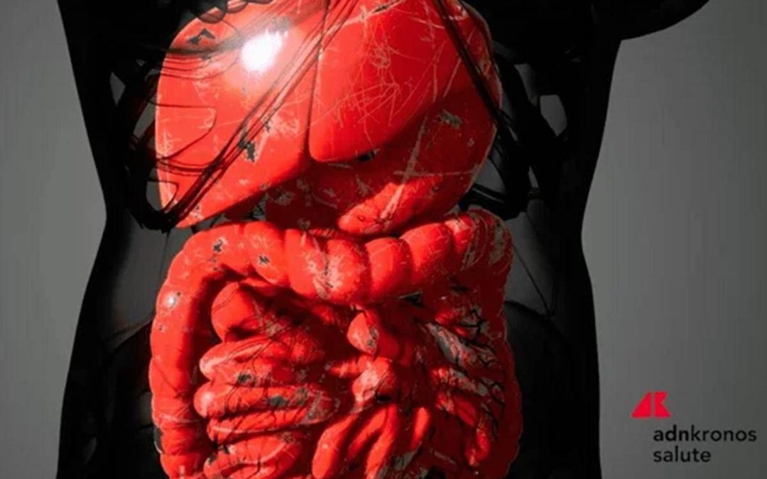 Farmaci, Aifa approva mirikizumab anche nel trattamento della malattia di Crohn