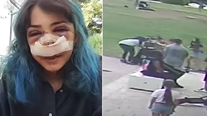 Picchiata al Parco Rossani, processo al via il 4 novembre: la 26enne ha pubblicato il video dell’aggressione