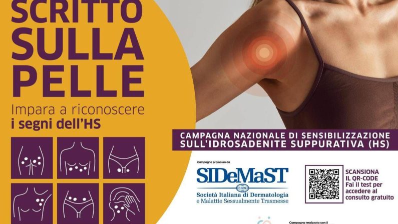 Idrosadenite suppurativa, al via campagna di sensibilizzazione ‘Scritto sulla pelle’