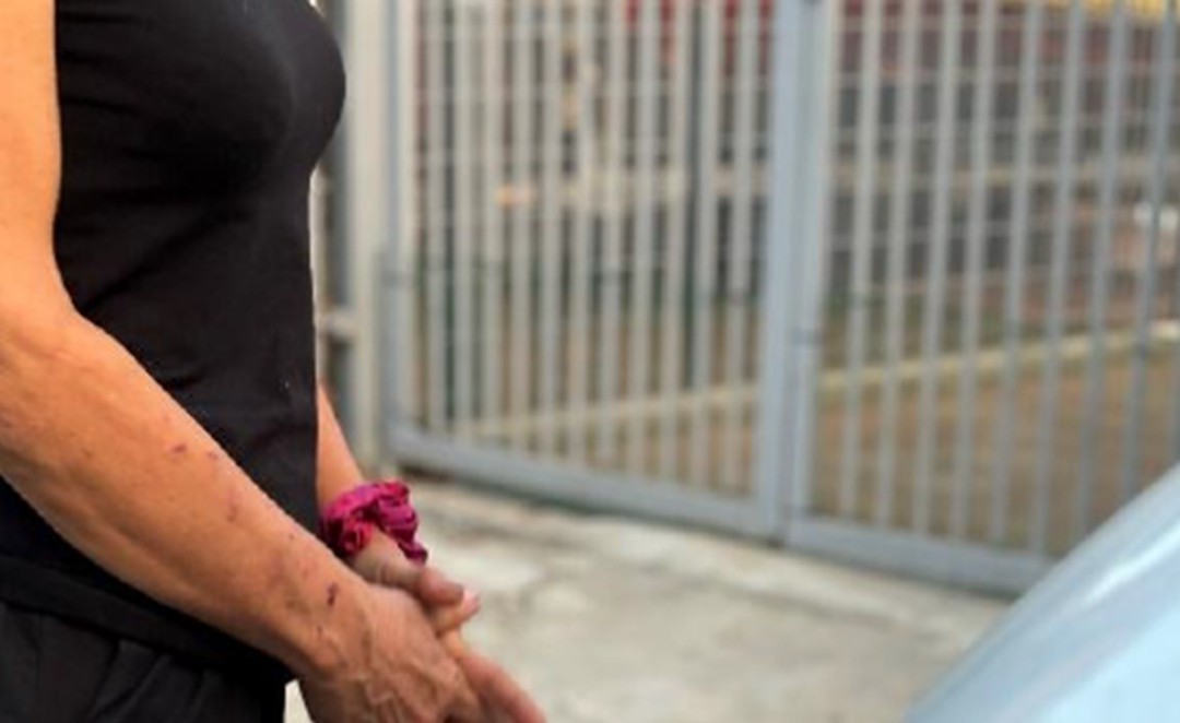 I graffi sull'avambraccio destro dell'indagata
