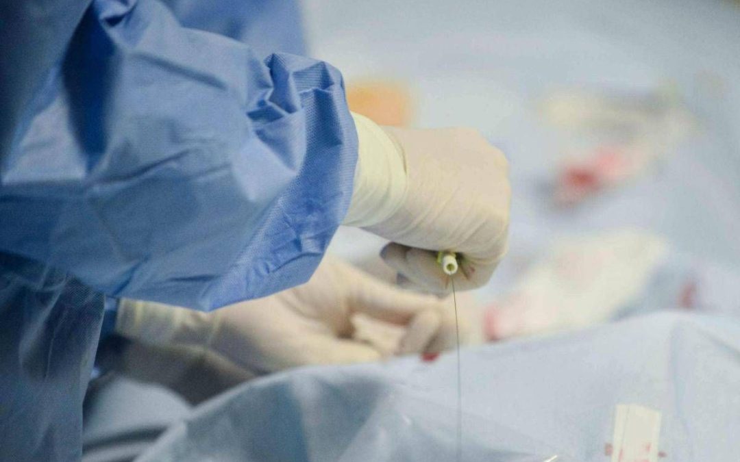 ‘Miracolato’ tre volte: a 85 anni supera terza rottura aorta con complesso intervento