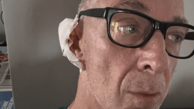 Linus ha una malattia della pelle: “Si chiama Epitelioma”. Di cosa si tratta